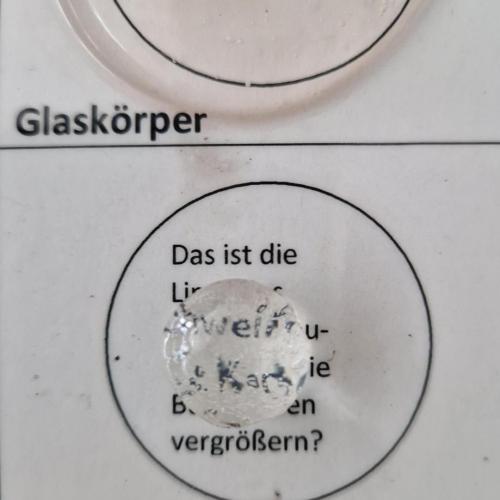 Linse und Glaskörper